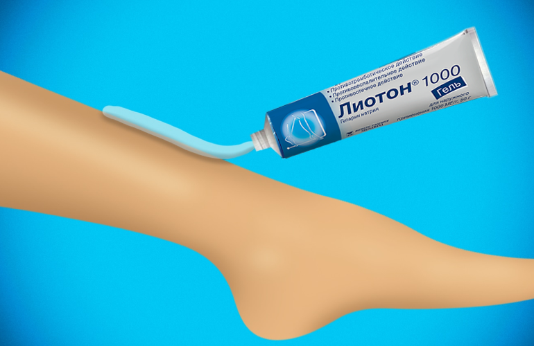 Применение препарата Лиотон® 1000 гельпри тяжести в ногах